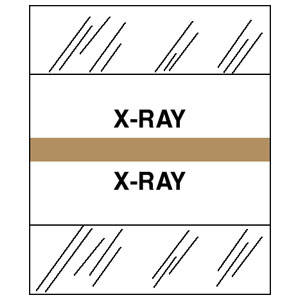 Stick On Index Tabs, X-RAY 1-1/2" X 1-1/4" (Pack of 100)